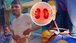 50 से 80 लाख की किडनी, ऑपरेशन के बाद कंबोडिया भेजे जाते थे ऑर्गन...चंद्रपुर किडनी रैकेट में खुलासा