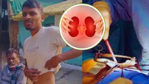 50 से 80 लाख की किडनी, ऑपरेशन के बाद कंबोडिया भेजे जाते थे ऑर्गन...चंद्रपुर किडनी रैकेट में खुलासा