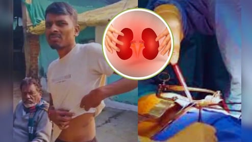 सूदखोर ने किसान की निकलवा ली थी किडनी, अब इंटरनेशनल रैकेट का हुआ खुलासा, नामी डॉक्टर भी शामिल