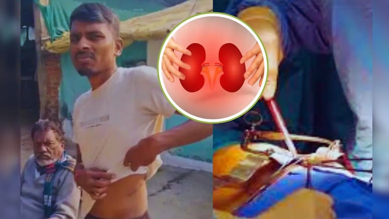 सूदखोर ने किसान की निकलवा ली थी किडनी, अब इंटरनेशनल रैकेट का हुआ खुलासा, नामी डॉक्टर भी शामिल