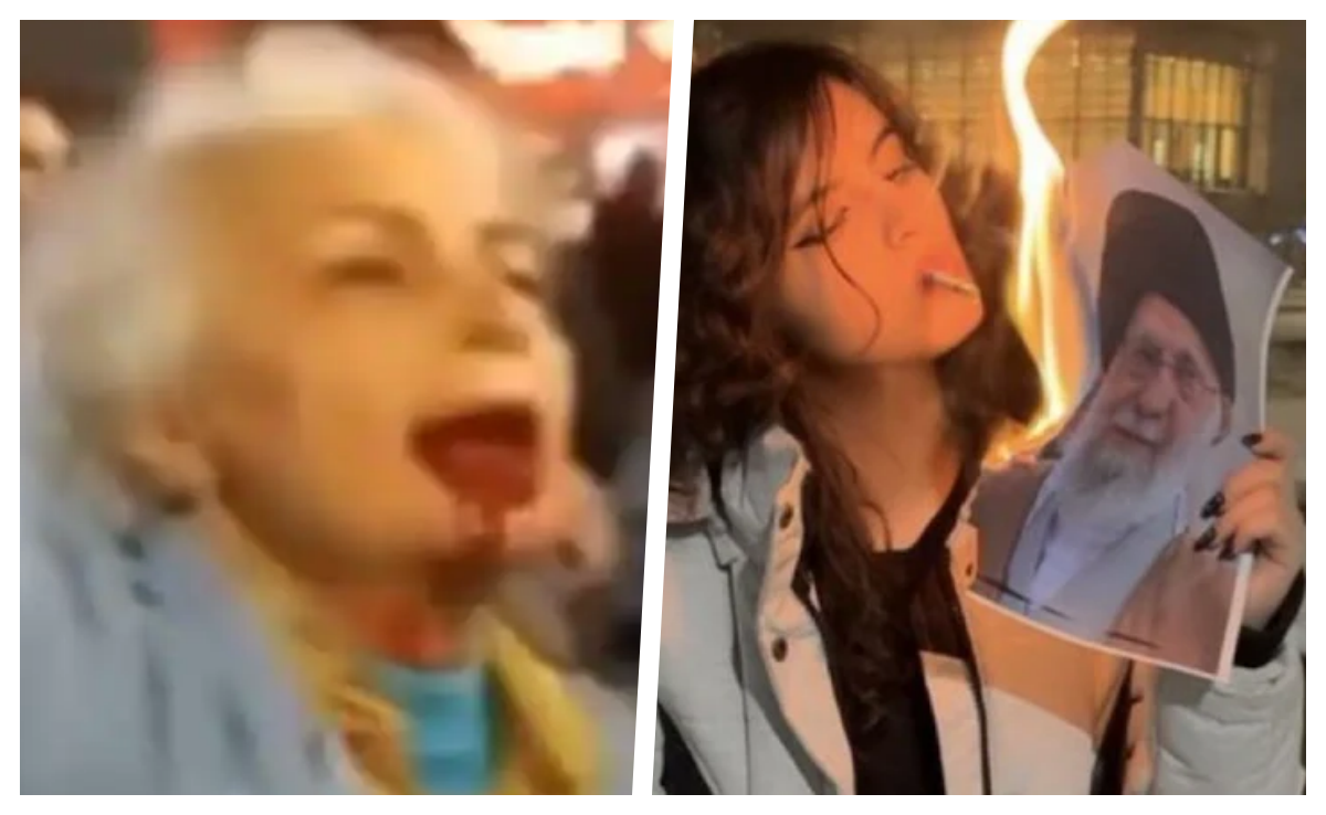 सिगरेट का धुआं, खून से लथपथ चेहरा&hellip;ईरान में हिजाब आजादी का परचम बनकर लहरा रहा