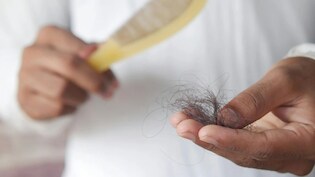 Hair Fall Test: कैसे पता चलेगा Hair Fall नॉर्मल है या किसी परेशानी की वजह से बाल झड़ रहे हैं?