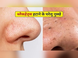 नाक के ब्लैकहेड्स को बिना पैसे खर्च किए हटाएं, त्वचा की अंदरूनी परत में जमी गंदगी कैसे साफ करें, डॉ. हंसा योगेन्द्र से जानिए