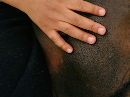 Chinese Woman Divorced Over Baldness Caused By Skin Disease Sparks Debate