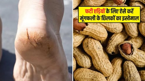 मूंगफली के छिलकों को फेंकिए मत, इस तरह करें फटी एड़ियों के लिए इस्तेमाल, मुलायम हो जाएगी त्वचा
