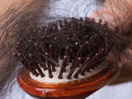 क्या सर्दियों में टोपी लगाने से बाल झड़ने लगते हैं? जानिए इसमें कितनी है सच्चाई