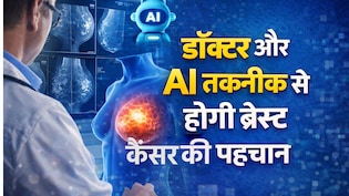 ब्रेस्ट कैंसर की पहचान में AI बना मददगार, दुनिया का पहला ट्रायल सफल