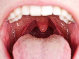 चमत्कार! 912 दिन बाद बंद हुआ 10 साल की बच्ची का मुंह, कोलकाता के डॉक्टर्स ने किया करिश्मा