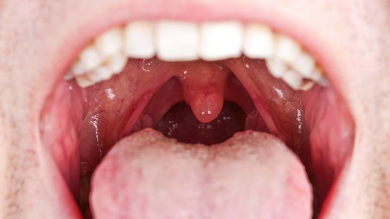 चमत्कार! 912 दिन बाद बंद हुआ 10 साल की बच्ची का मुंह, कोलकाता के डॉक्टर्स ने किया करिश्मा