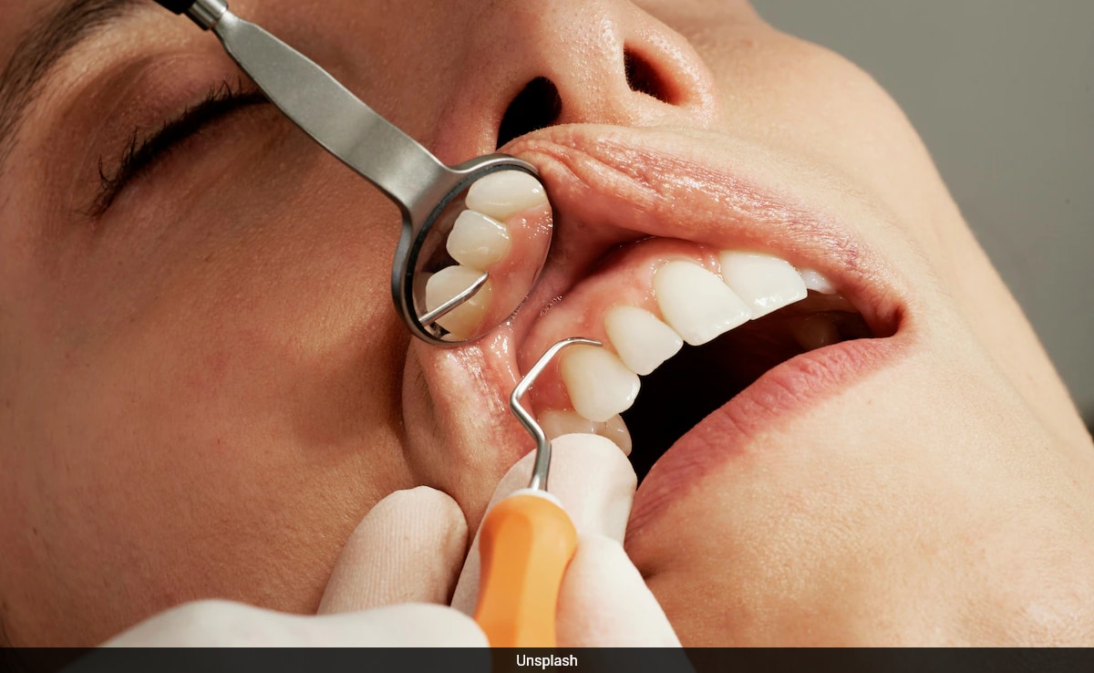 ये 4 संकेत बताते हैं समय से पहले बूढ़े हो रहे आपके दांत, जानें इन्हें जवां और मजबूत बनाए रखने के 5 बेस्ट तरीके