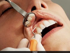 ये 4 संकेत बताते हैं समय से पहले बूढ़े हो रहे आपके दांत, जानें इन्हें जवां और मजबूत बनाए रखने के 5 बेस्ट तरीके