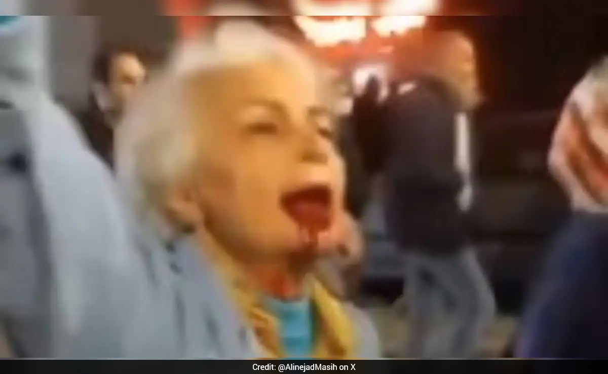 Iran Woman's "Bloody" Protest: "I Have Been Dead For 47 Years"