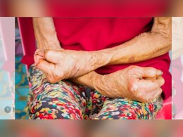 Leprosy Day 2026: दुनियाभर में कुष्ठ रोग के 53 प्रतिशत मामले सिर्फ भारत में, बीमारी से ज्यादा खतरनाक है छुआछूत का कलंक