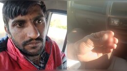 राजस्&zwj;थान: जीजा ने साले की काटी नाक, पत्&zwj;नी की दूसरी जगह शादी करने पर था नाराज&nbsp;