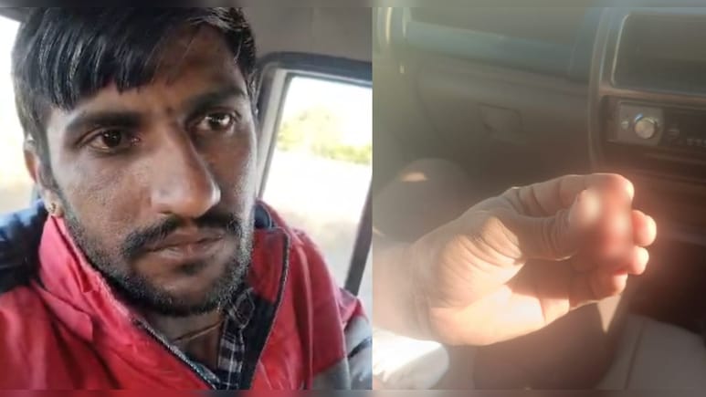 राजस्&zwj;थान: जीजा ने साले की काटी नाक, पत्&zwj;नी की दूसरी जगह शादी करने पर था नाराज&nbsp;