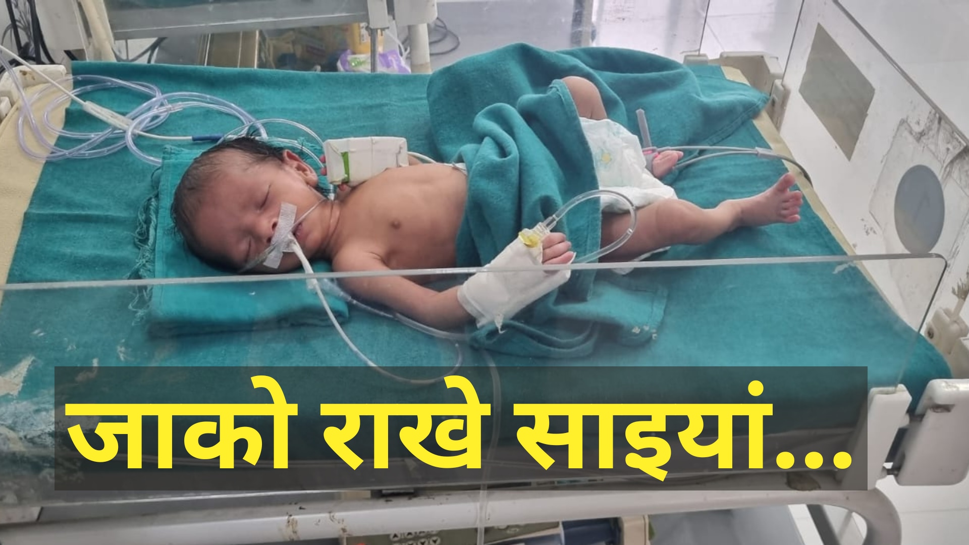 Monkey Attack: हॉस्पिटल में नवजात Monkey Attack: हॉस्पिटल में नवजात