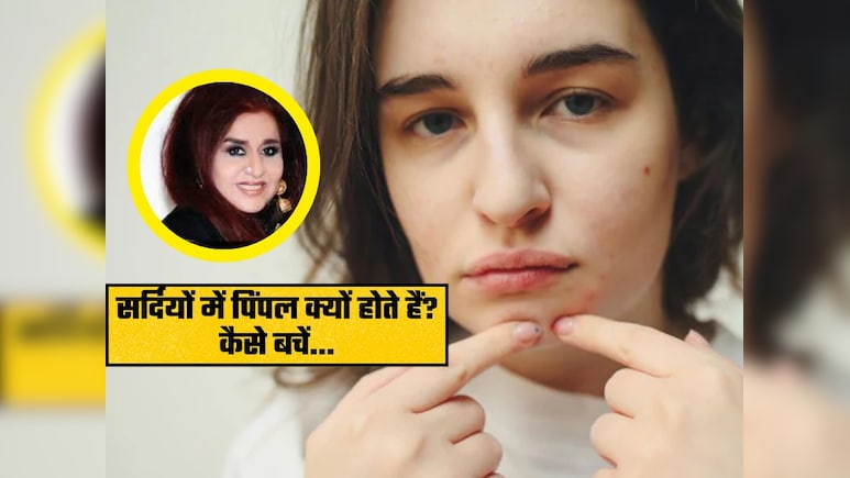 सर्दियों में होते हैं पिंपल्स? शहनाज हुसैन ने बताया इस समस्या का हल, स्किन रहेगी फ्रेश