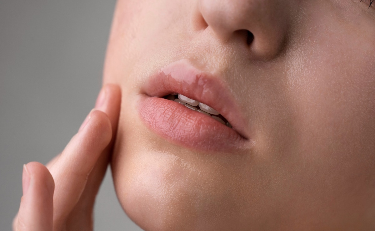8 Natural Home Remedies For Chapped Lips In Winters