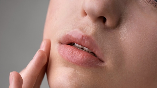 Chapped lips are a familiar winter problem for many, as the winter chill brings dryness and mositure loss