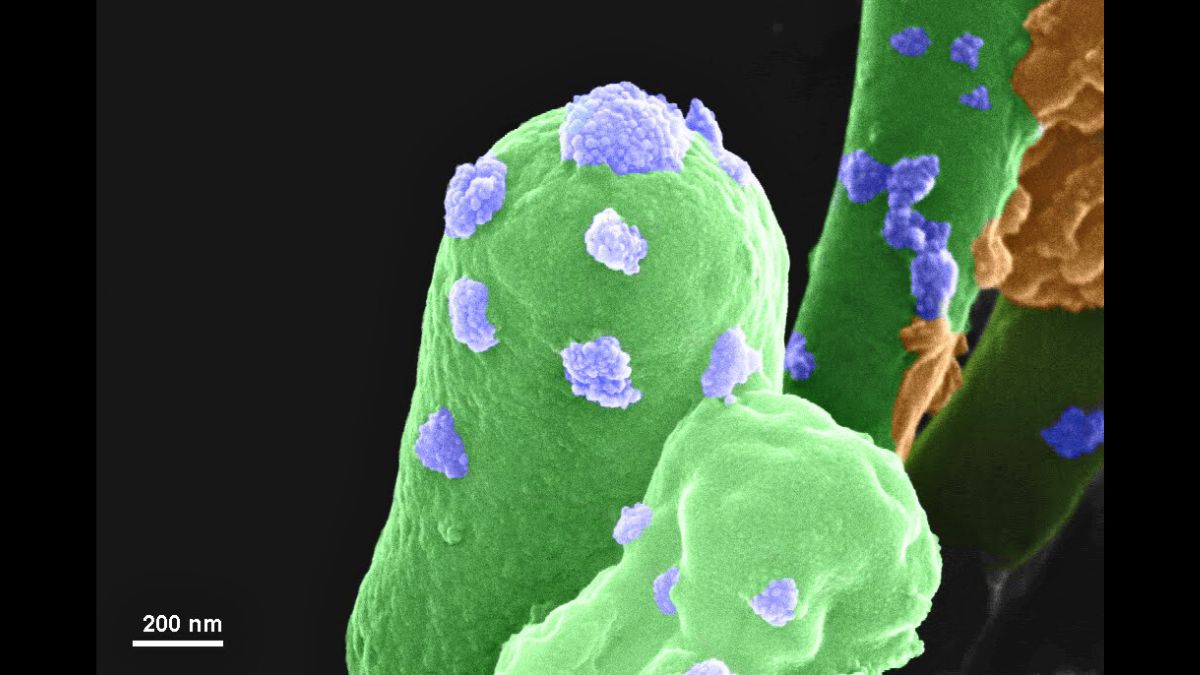 The bacterium Sporosarcina pasteurii collected from Bengaluru soils that aided the process