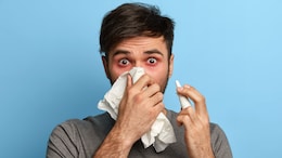 Sudden Nose Block, Eyes Tearing Up? Follow These Tips To Get Instant Relief