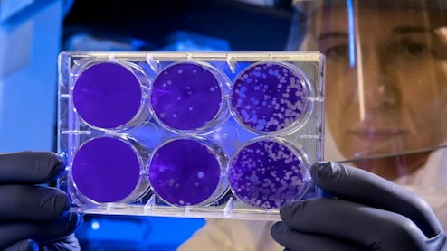 अस्पतालों में फैला जानलेवा फंगस Candida auris, पूरी दुनिया पर मंडरा रहा खतरा, अलर्ट जारी