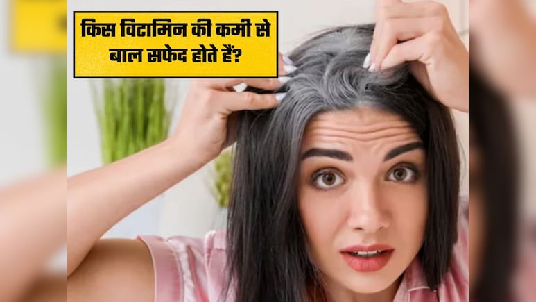शरीर में इस विटामिन की कमी से सफेद हो रहे हैं बाल, जानिए कैसे मिलेगी राहत
