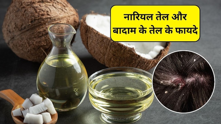 Coconut Oil vs Almond Oil: नारियल तेल और बादाम के तेल के फायदे, सर्दियों में स्कैल्प के लिए कौन सा बेहतर है?