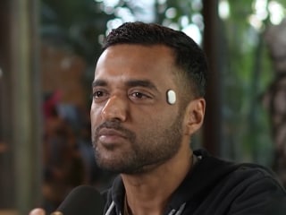 Zomato CEO के माथे में क्या लगा था? इस दिमाग पढ़ने वाले डिवाइस ने सोशल मीडिया पर छेड़ दी बहस