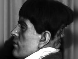 इतिहास का सबसे दुर्लभ केस, एक-दूसरे के दुश्मन बने इंसान के 2 चेहरे, कहानी का अंत रुला देगा