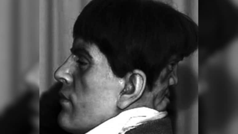 इतिहास का सबसे दुर्लभ केस, एक-दूसरे के दुश्मन बने इंसान के 2 चेहरे, कहानी का अंत रुला देगा