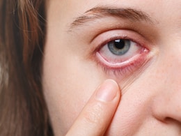 7 Signs And Symptoms Of An Eye Infection