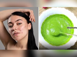 मुंहासे, डार्क स्पॉट्स और ओपन पोर्स से मिलेगा छुटकारा, नीम के पत्तों से बनाएं ये देसी फेस मास्क, योग गुरु कैलाश ने बताया तरीका