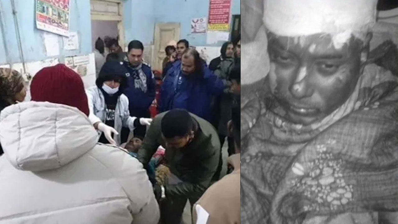 Hindu Man Khokon Das Dies After Being Beaten, Set On Fire In Bangladesh