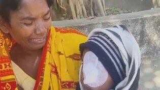 ओडिशा में स्नैक पैकेट से निकले खिलौने को आग में फेंका, 8 साल के बच्चे की चली गई आंख