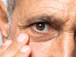 Can You Have Eye Disease Without Symptoms? Understanding Glaucoma