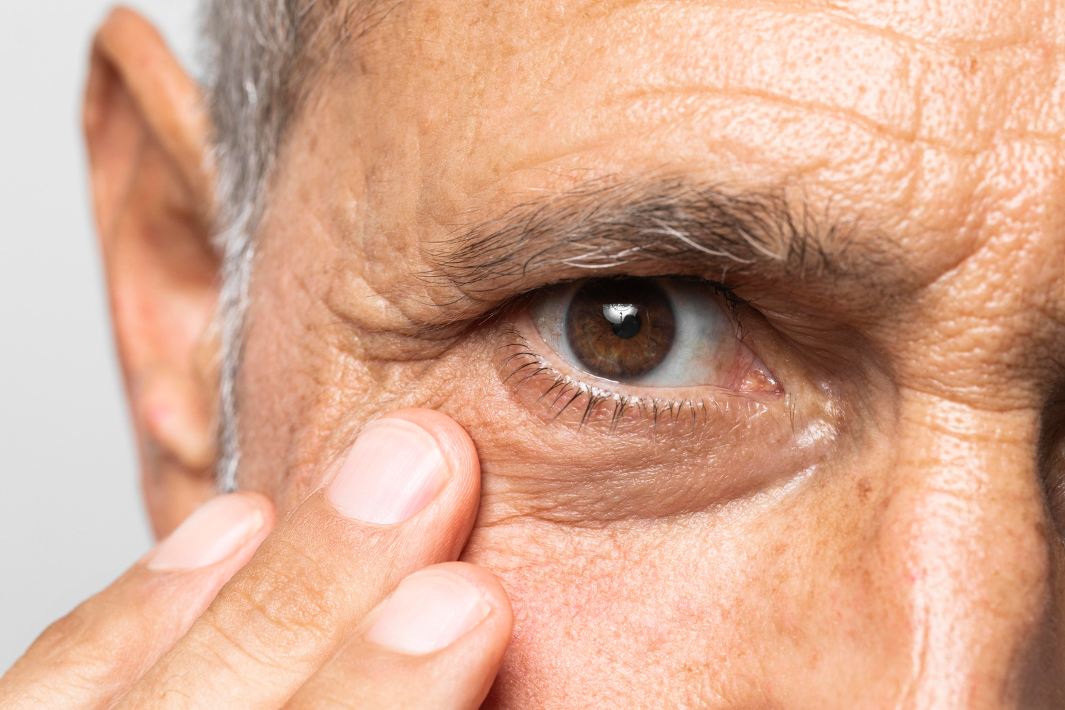 Can You Have Eye Disease Without Symptoms? Understanding Glaucoma
