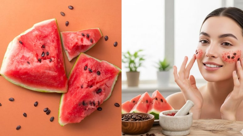 स्किन को ग्लोइंग बनाने के लिए इस्तेमाल करें तरबूज के बीज, ये है सही तरीका, मुंहासों से भी मिलेगा छुटकारा