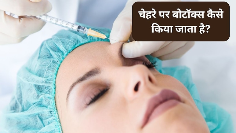 बोटॉक्स ट्रीटमेंट क्या होता है? बोटॉक्स का असर कितने समय तक रहता है, जानिए चेहरे और बालों के लिए कितना सेफ