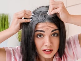 Grey Hair In 20s? Possible Causes And Solutions Explained