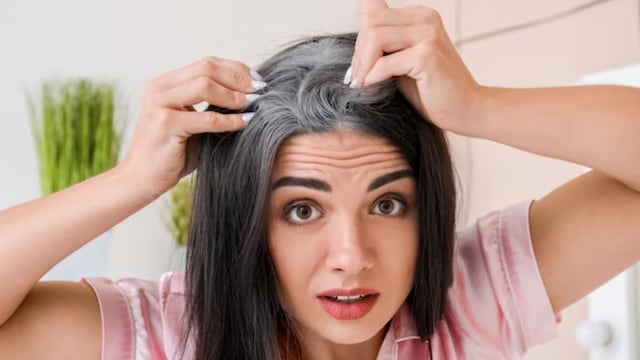 Family history is the primary factor in the timing of grey hair