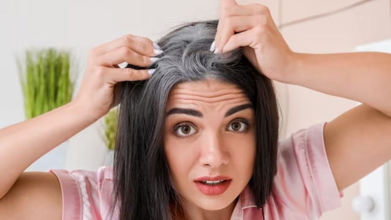 Grey Hair In 20s? Possible Causes And Solutions Explained