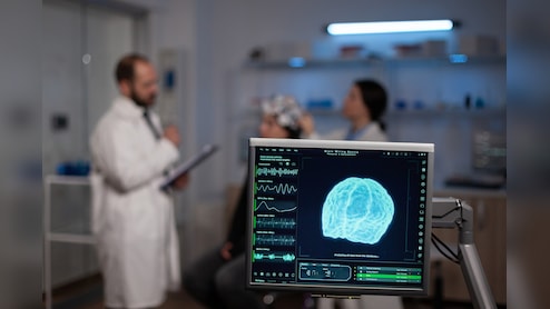 आईआईटी बॉम्बे ने विकसित किया 'सुपर डेटाबेस', अल्जाइमर और पार्किंसंस जैसी बीमारियों की खुलेगी गुत्थी