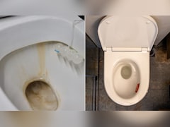 Toilet Seat पर लगे जिद्दी पीले दाग कैसे साफ होंगे? जानें बिना हाथ लगाए कैसे करें टॉयलेट की सफाई