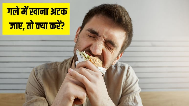 खाना सांस की नली में फंस जाए तो क्या करना चाहिए? डॉक्टर ने बताया गले में कुछ अटक जाए तो सबसे पहले क्या करें