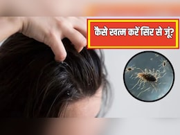 सिर से एक-एक जूं को खत्म कर देंगे ये 2 उपाय, बालों में चिपकी लीख भी हो जाएंगी साफ, बस जान लें क्या करें