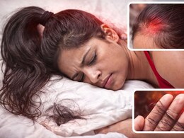 रात को बाल बांधकर सोएं या खोलकर? ये एक गलती बना सकती है आपको गंजा