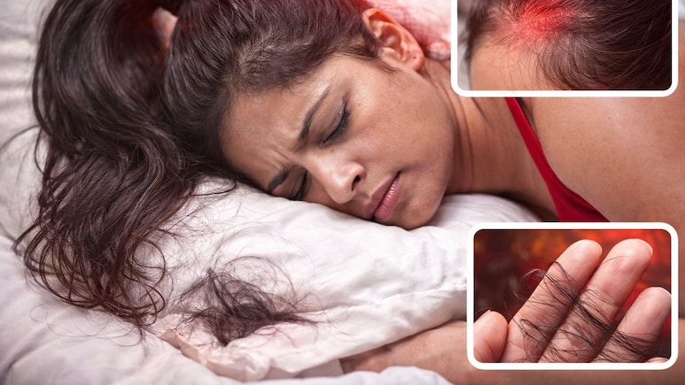 रात को बाल बांधकर सोएं या खोलकर? ये एक गलती बना सकती है आपको गंजा