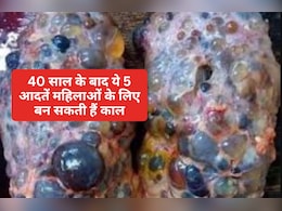 सावधान! 93% महिलाओं को नहीं है पता 40 के बाद ये 5 आदतें किडनी कर सकती हैं फेल, डॉक्टर ने दी चेतावनी