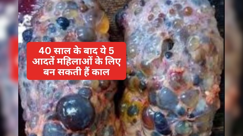 सावधान! 93% महिलाओं को नहीं है पता 40 के बाद ये 5 आदतें किडनी कर सकती हैं फेल, डॉक्टर ने दी चेतावनी
